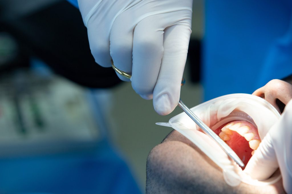 Root Canals Vs. Tooth Extractions - Which Is Better?